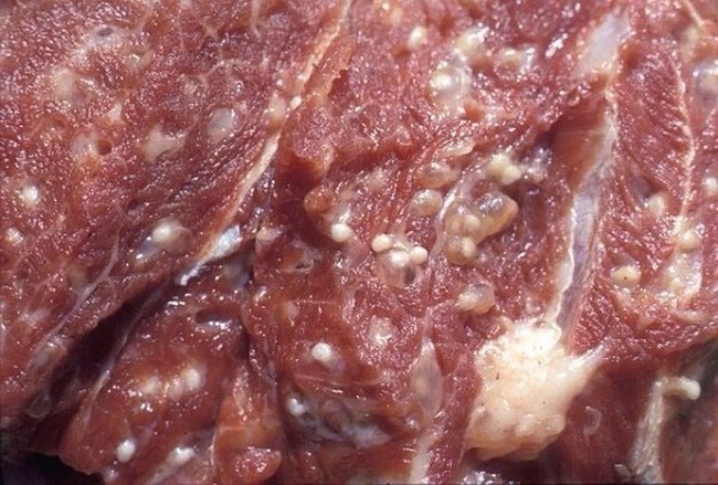 Ăn phải thịt lợn nhiễm sán gây nỗi kinh hãi thế nào cho sức khỏe? - Ảnh 4.