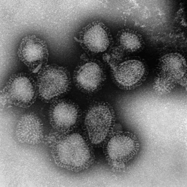 WHO cảnh báo: Đại dịch cúm là thảm họa tiếp theo sẽ xảy ra - Chuyên gia khuyến cáo việc nên làm để phòng bệnh - Ảnh 2.