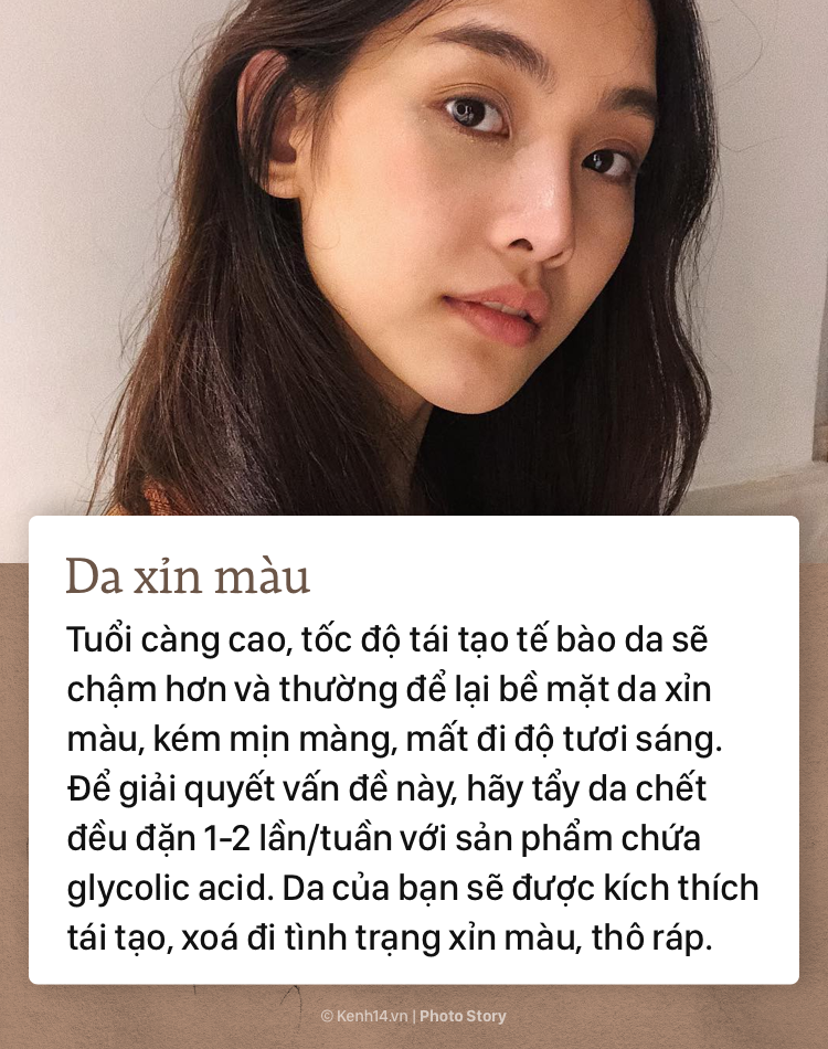 Nhận biết 5 dấu hiệu lão hoá bắt đầu bước qua tuổi 20 và cách khắc phục những vấn đề này - Ảnh 9. Nhận biết 5 dấu hiệu lão hoá bắt đầu bước qua tuổi 20 và cách khắc phục những vấn đề này - Ảnh 9.