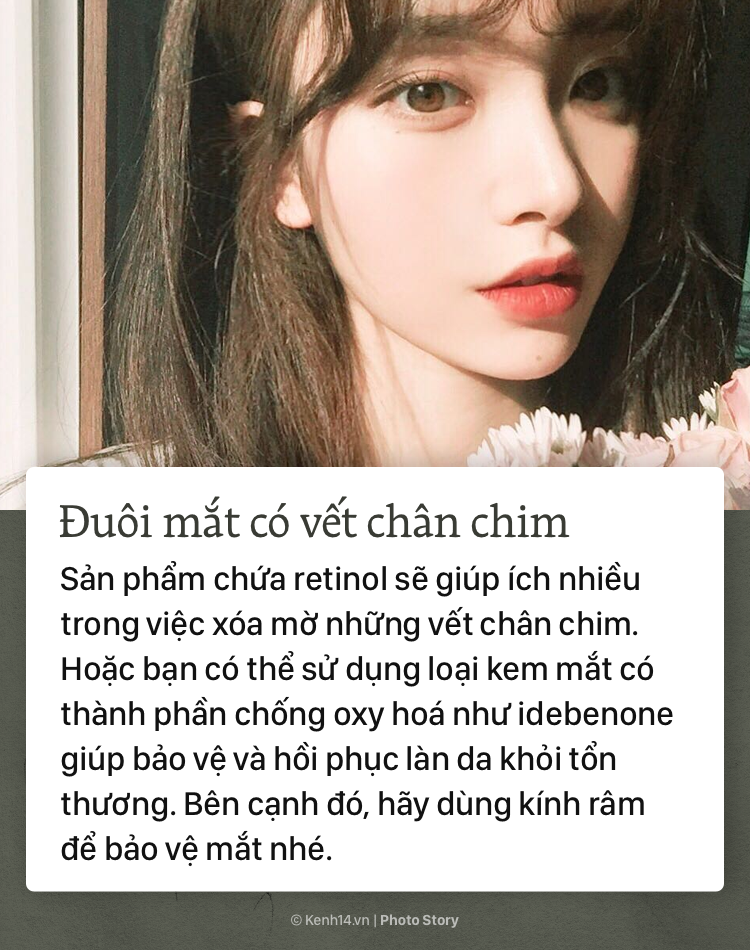 Da xuất hiện vết chân chim do lão hóa - Ảnh 11. Da xuất hiện vết chân chim do lão hóa - Ảnh 11.