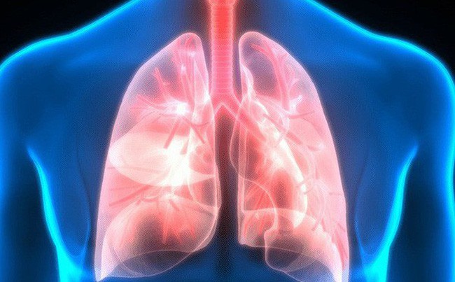 Nguy hiểm khi bụi mịn đi thẳng vào phổi, phải làm gì để làm sạch phổi ngay hôm nay? - Ảnh 3.