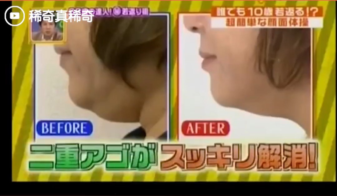 Học người Nhật c&aacute;ch giảm mỡ nọng cằm sau 1 th&aacute;ng với động t&aacute;c chỉ tốn v&agrave;i gi&acirc;y thực hiện - Ảnh 2.