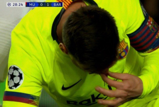 Messi chảy máu đầm đìa sau khi bị trung vệ MU gạt tay trúng mặt - Ảnh 2.