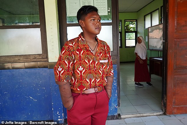 Từng được coi là ‘bé trai nặng nhất thế giới’, cậu bé Indonesia béo đến không thể đi học nổi giờ ra sao? - Ảnh 5.