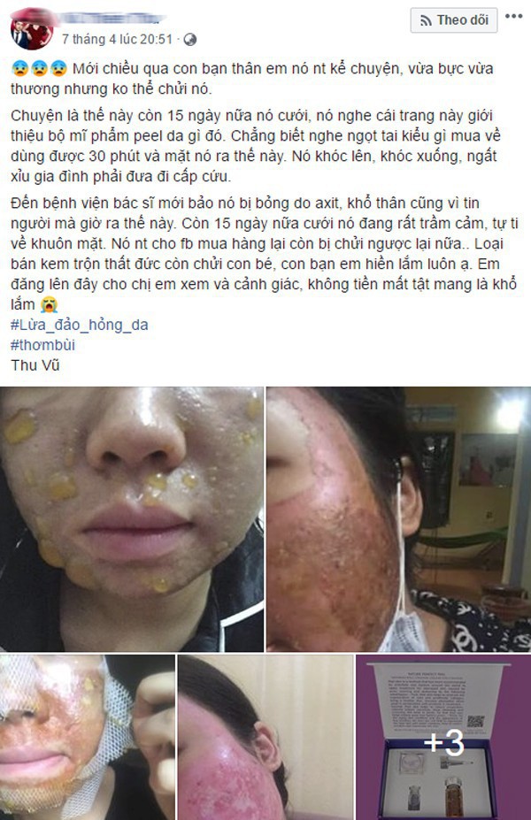 Không chỉ kem trộn, xu hướng tự peel da tại nhà cũng có thể khiến bạn hóa quỷ sau 1 lần sử dụng - Ảnh 1.