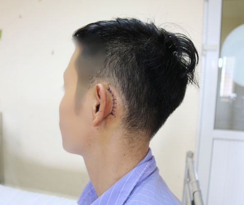  Sạc điện thoại b&ecirc;n gối, nam thanh ni&ecirc;n thủng m&agrave;ng nhĩ  - Ảnh 2.