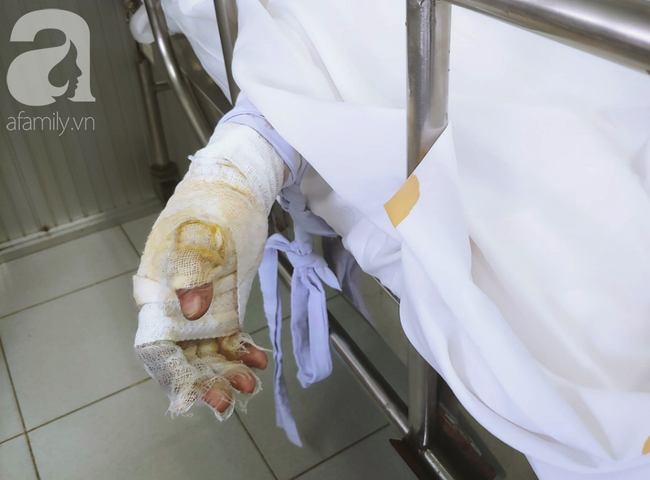 Vụ người phụ nữ nghi dùng xăng đốt chồng rồi tự thiêu: Người chồng liên tục gọi vợ trong phòng chăm sóc đặc biệt - Ảnh 4.