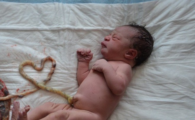 D&acirc;n mạng li&ecirc;n tục chia sẻ c&acirc;u chuyện cặp vợ chồng tự đỡ đẻ tại nh&agrave; theo phương ph&aacute;p thuận tự nhi&ecirc;n: Bộ Y tế c&ugrave;ng c&aacute;c chuy&ecirc;n gia đ&atilde; n&oacute;i g&igrave;? - Ảnh 2.