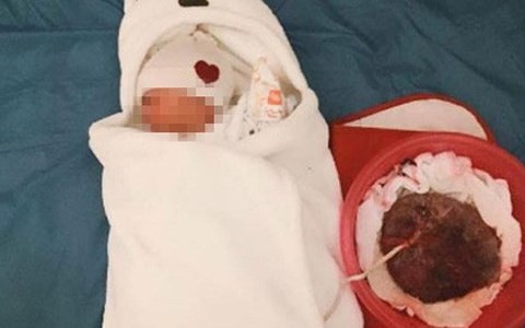 D&acirc;n mạng li&ecirc;n tục chia sẻ c&acirc;u chuyện cặp vợ chồng tự đỡ đẻ tại nh&agrave; theo phương ph&aacute;p thuận tự nhi&ecirc;n: Bộ Y tế c&ugrave;ng c&aacute;c chuy&ecirc;n gia đ&atilde; n&oacute;i g&igrave;? - Ảnh 3.