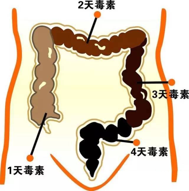 Cô gái Trung Quốc bị táo bón nặng chỉ vì thói quen mà giới trẻ thường hay mắc phải - Ảnh 1.