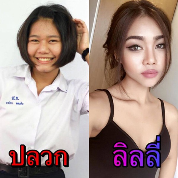 Hot girl bốc lửa Thái Lan bất ngờ công khai ảnh phẫu thuật để có eo con kiến, điều đáng nói đây không phải lần đầu cô lột xác  - Ảnh 3.