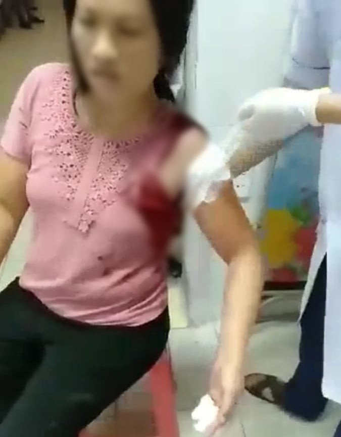 Cãi nhau, người đàn ông dùng dao đâm vợ hờ rồi bỏ chạy - Ảnh 1. Cãi nhau, người đàn ông dùng dao đâm vợ hờ rồi bỏ chạy - Ảnh 1.