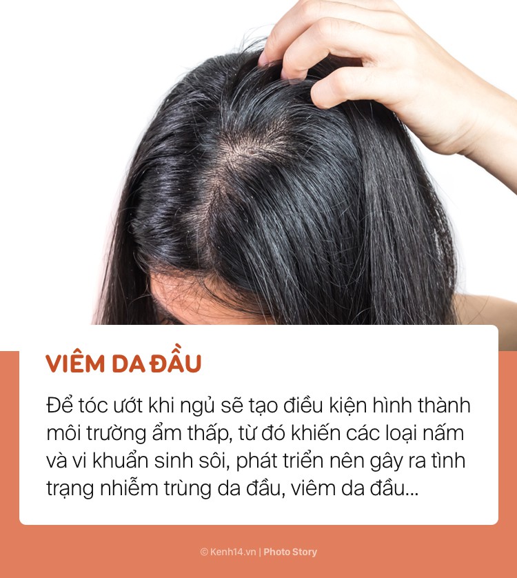 Bất chấp để tóc ướt đi ngủ, bạn sẽ có nguy cơ gặp phải những vấn đề sức khoẻ này - Ảnh 3.