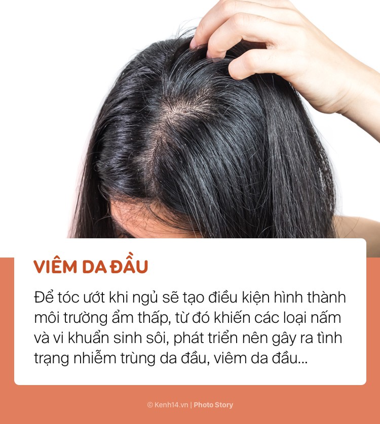Bất chấp để tóc ướt đi ngủ, bạn sẽ có nguy cơ gặp phải những vấn đề sức khoẻ này - Ảnh 3. Bất chấp để tóc ướt đi ngủ, bạn sẽ có nguy cơ gặp phải những vấn đề sức khoẻ này - Ảnh 3.