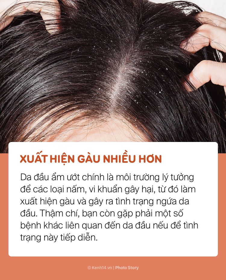Bất chấp để tóc ướt đi ngủ, bạn sẽ có nguy cơ gặp phải những vấn đề sức khoẻ này - Ảnh 7. Bất chấp để tóc ướt đi ngủ, bạn sẽ có nguy cơ gặp phải những vấn đề sức khoẻ này - Ảnh 7.