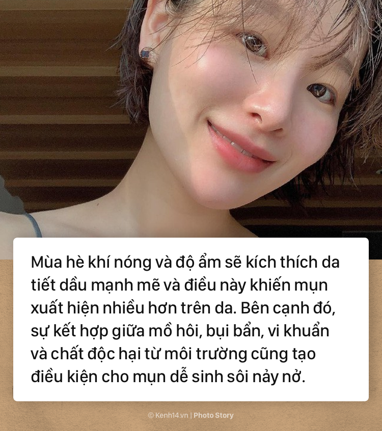 Để khắc phục tình trạng mụn biểu tình vào mùa hè các nàng cần chú ý ngay tips skincare sau - Ảnh 1.