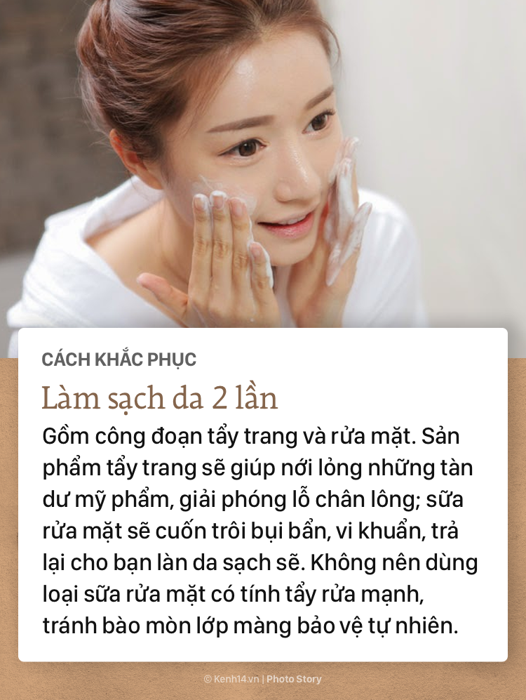 Để khắc phục tình trạng mụn biểu tình vào mùa hè các nàng cần chú ý ngay tips skincare sau - Ảnh 5.