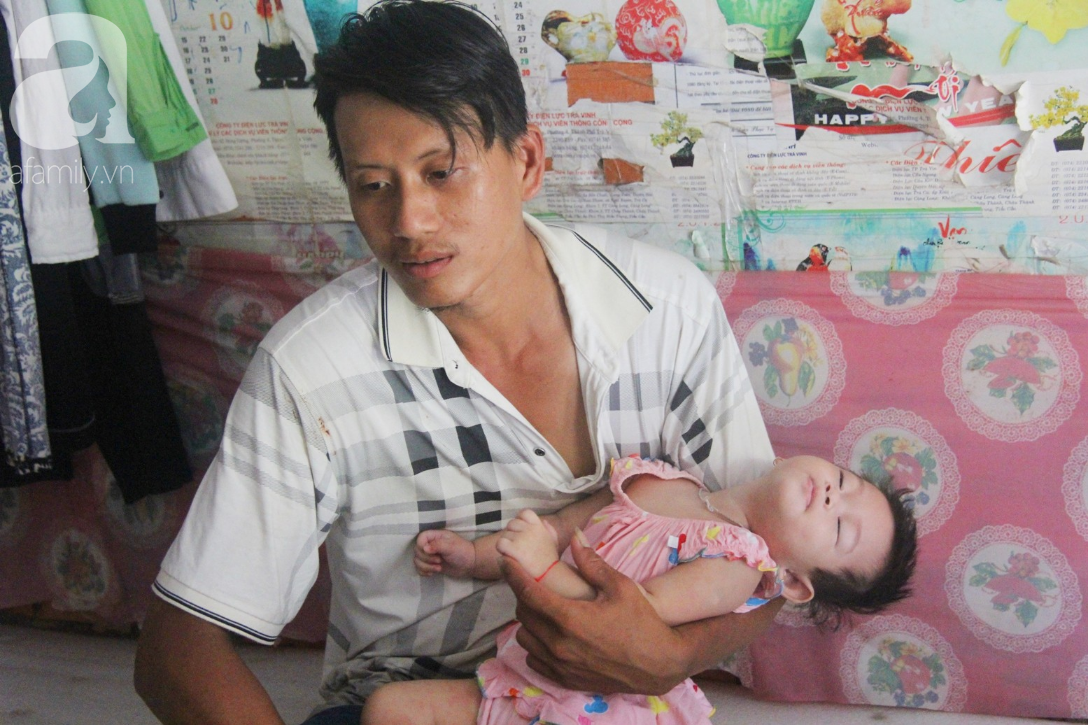 Bé gái 1 tuổi co giật liên tục đến mức méo miệng, người mẹ trẻ khóc cạn nước mắt cầu xin một cơ hội sống cho con - Ảnh 5.
