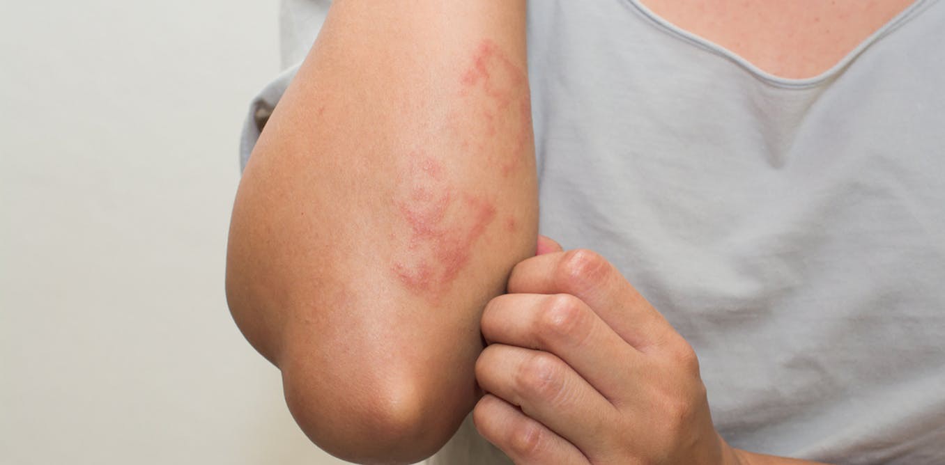 Hội dùng nước ép cần tây để làm đẹp da cần lưu ý các tác dụng phụ được bác sĩ cảnh báo sau đây - Ảnh 1. Hội dùng nước ép cần tây để làm đẹp da cần lưu ý các tác dụng phụ được bác sĩ cảnh báo sau đây - Ảnh 1.
