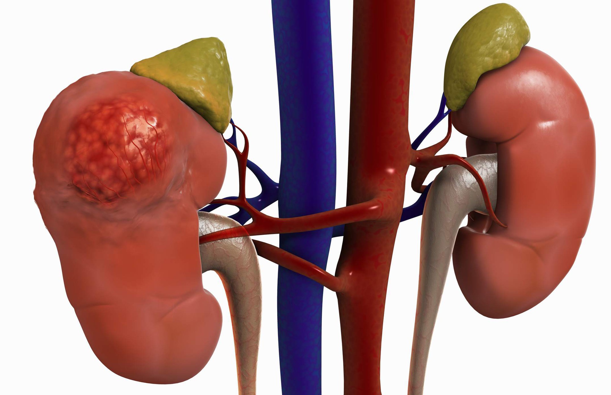 Hội dùng nước ép cần tây để làm đẹp da cần lưu ý các tác dụng phụ được bác sĩ cảnh báo sau đây - Ảnh 4. Hội dùng nước ép cần tây để làm đẹp da cần lưu ý các tác dụng phụ được bác sĩ cảnh báo sau đây - Ảnh 4.