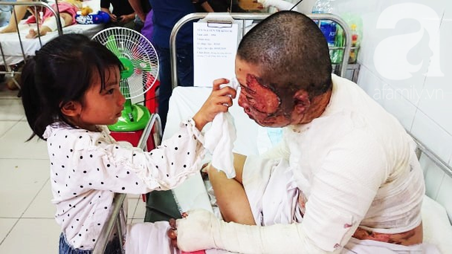 Bố d&ugrave;ng xăng đốt khiến mẹ biến dạng khu&ocirc;n mặt, con g&aacute;i 8 tuổi kh&oacute;c ngất: Mẹ c&oacute; xấu nhưng con vẫn nhận ra mẹ m&agrave; - Ảnh 13.