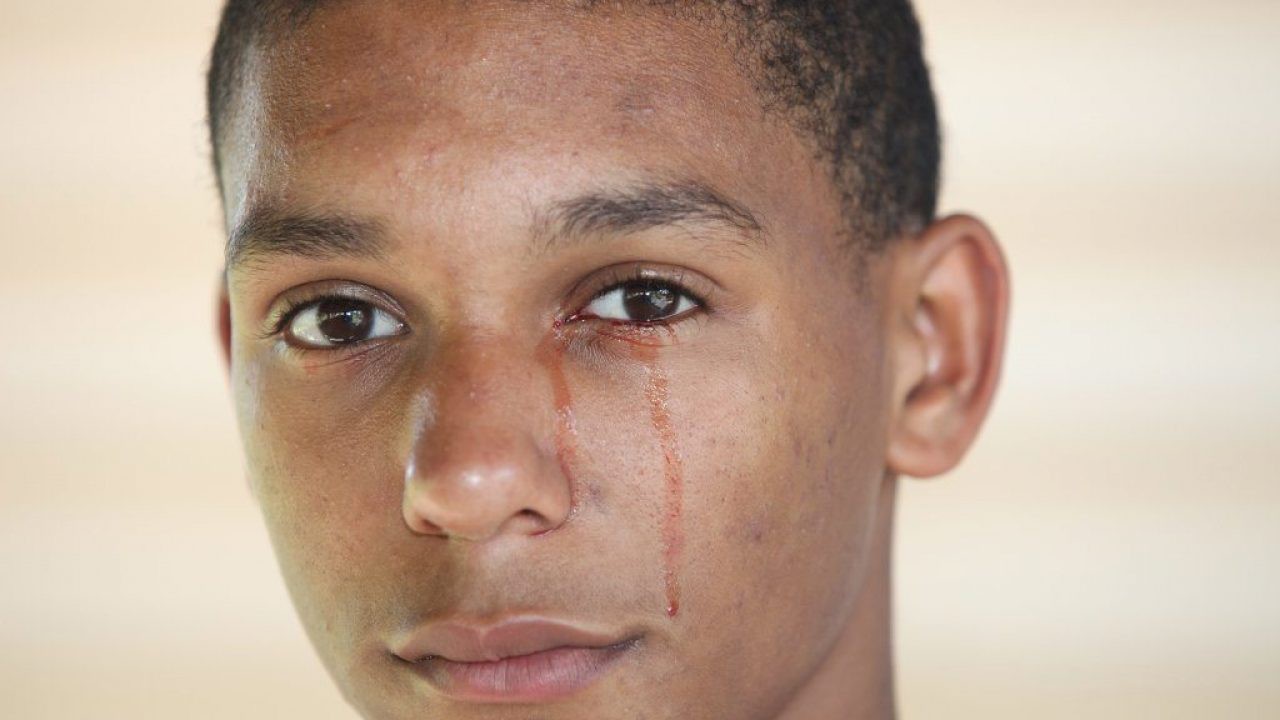 C&oacute; 1 hội chứng khiến con người ta kh&oacute;c ra m&aacute;u nhưng kh&ocirc;ng phải ai cũng biết tới - Ảnh 2.