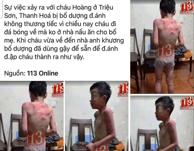 Xác minh thông tin bé trai ở Thanh Hóa bị bố dượng đánh đập lan truyền trên Facebook - Ảnh 1.