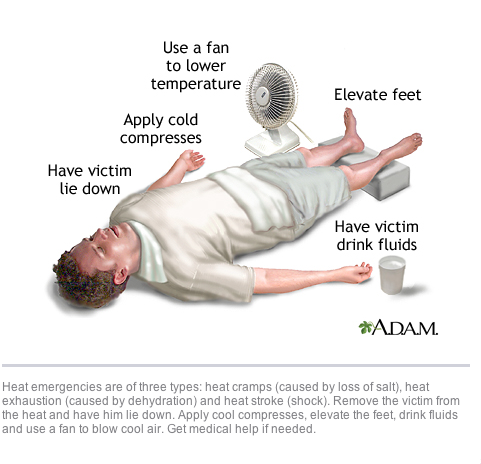 Sốc nhiệt là gì: Bạn nên sơ cứu thế nào và các biện pháp phòng tránh? - Ảnh 2.