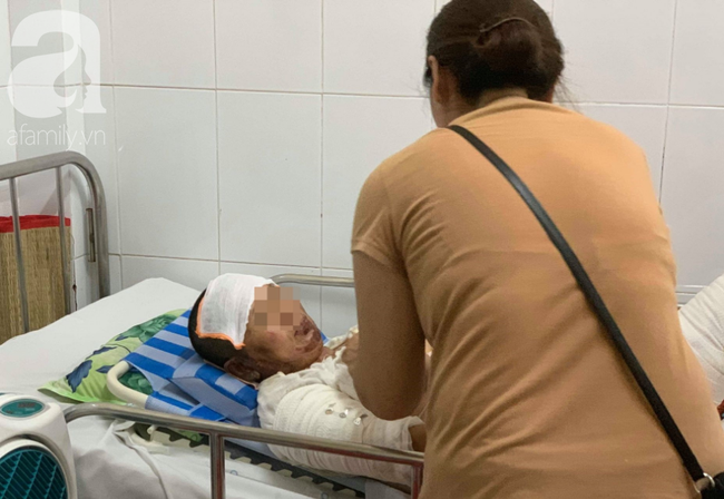 Phẫn nộ: Chồng nhậu say rồi về gây sự, mua xăng đốt vợ khiến nạn nhân bị bỏng nặng - Ảnh 2. Phẫn nộ: Chồng nhậu say rồi về gây sự, mua xăng đốt vợ khiến nạn nhân bị bỏng nặng - Ảnh 2.