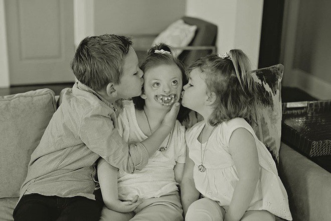 B&eacute; g&aacute;i từng bị miệt thị c&ocirc;ng khai v&igrave; diện mạo khiếm khuyết g&acirc;y x&uacute;c động MXH, tr&uacute;t hơi thở cuối c&ugrave;ng ở tuổi l&ecirc;n 10 - Ảnh 2.