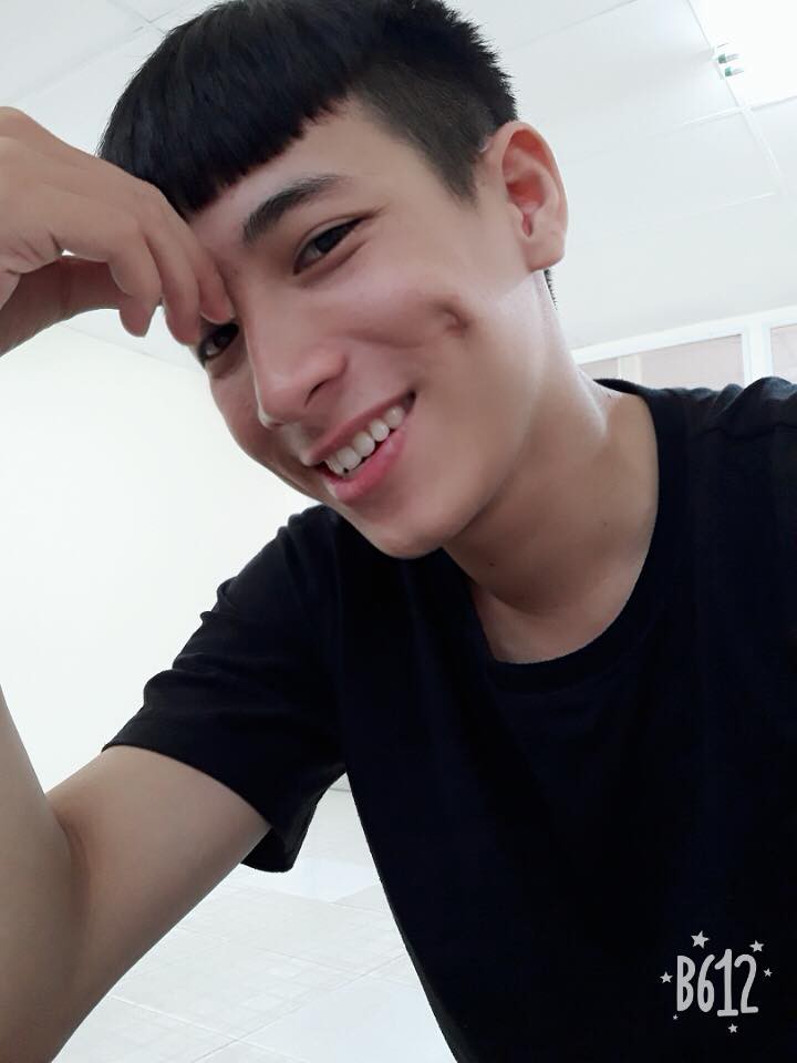 Vì pha nghịch dại hồi bé, thanh niên được khuyến mãi thêm lúm đồng tiền to bự khiến ai nhìn cũng phải khen duyên - Ảnh 3. Vì pha nghịch dại hồi bé, thanh niên được khuyến mãi thêm lúm đồng tiền to bự khiến ai nhìn cũng phải khen duyên - Ảnh 3.
