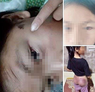 C&ocirc;ng an vi&ecirc;n đ&aacute;nh b&eacute; g&aacute;i 12 tuổi t&iacute;m người v&igrave; nghi trộm 50.000 đồng - Ảnh 1.