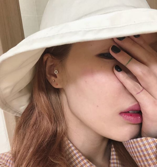 Té trầy mặt trên sân khấu, HyunA tức tốc đến bệnh viện khám nhưng điều này mới gây chú ý vì ngoài sức tưởng tượng - Ảnh 3.