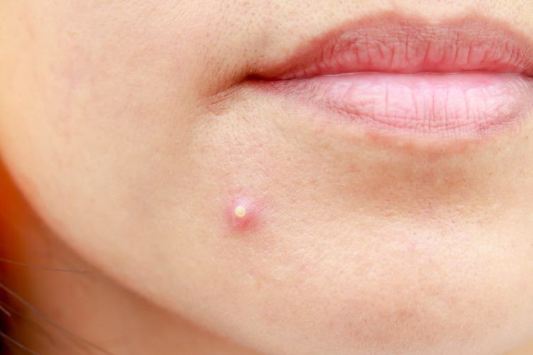 Cứ lặp lại thường xuyên những triệu chứng này có thể là do gan của bạn chứa đầy độc tố - Ảnh 2.