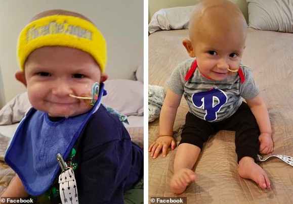 Thấy đầu con nghiêng nhẹ sang phải, bố mẹ không ngờ con trai 3 tháng tuổi bị bệnh ung thư nghiêm trọng đến thế - Ảnh 2.