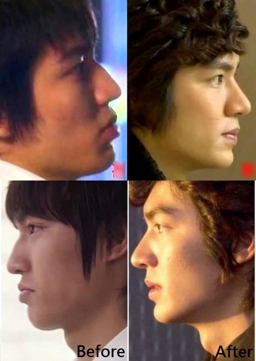 Khoe ảnh đẹp trai và sang chảnh ở Paris, nhưng Lee Min Ho sao lại lộ sống mũi cao vều như mỏ vịt thế này? - Ảnh 4. Khoe ảnh đẹp trai và sang chảnh ở Paris, nhưng Lee Min Ho sao lại lộ sống mũi cao vều như mỏ vịt thế này? - Ảnh 4.