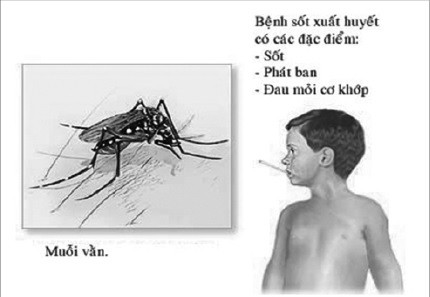 Thuốc nào nên và không nên dùng khi bị sốt xuất huyết? - Ảnh 1.