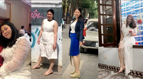 Cô gái Hà Nội nặng gần 100kg cắt dạ dày để giảm cân - Ảnh 1.