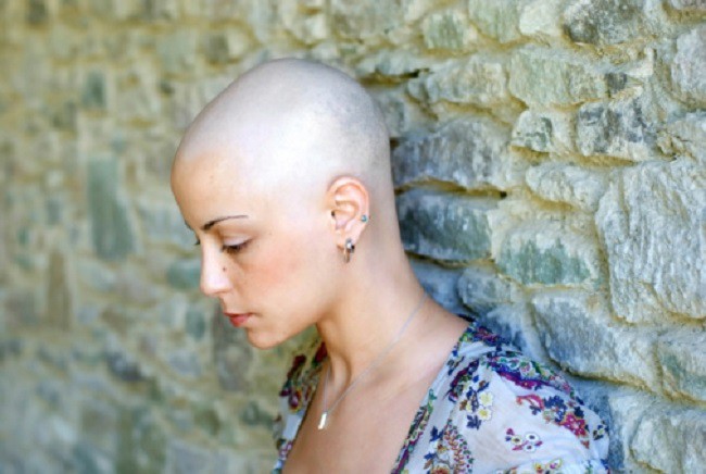 Bị ung thư vú phải hóa trị rụng hết tóc, ốm yếu không đi làm được, người phụ nữ rụng rời khi nghe tin... bác sĩ nhầm - Ảnh 2.
