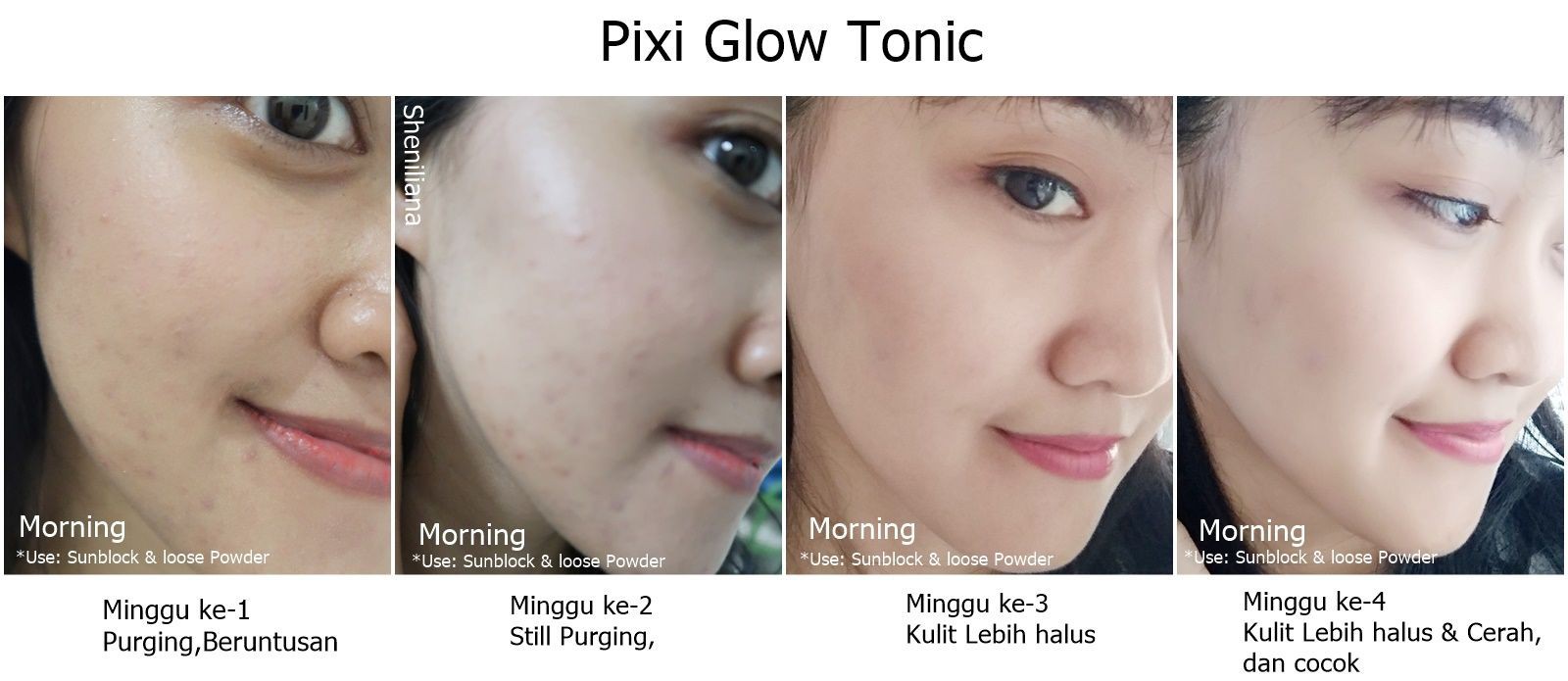 Không có tiền mua chai toner xịn sò giá 2,6 triệu, bạn có thể tìm đến 6 phiên bản bình dân rẻ hều này - Ảnh 4.