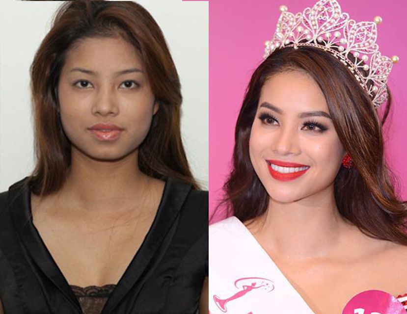 Phạm Hương bị diễn đàn sắc đẹp quốc tế tố đã trải qua nhiều cuộc phẫu thuật thẩm mỹ - Ảnh 2. Phạm Hương bị diễn đàn sắc đẹp quốc tế tố đã trải qua nhiều cuộc phẫu thuật thẩm mỹ - Ảnh 2.