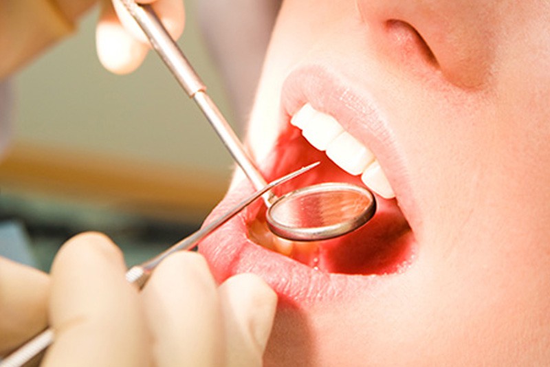 Cái giá của sự đẹp: Cận cảnh quy trình bọc răng sứ khiến người xem cũng phải thót tim - Ảnh 12. Cái giá của sự đẹp: Cận cảnh quy trình bọc răng sứ khiến người xem cũng phải thót tim - Ảnh 12.