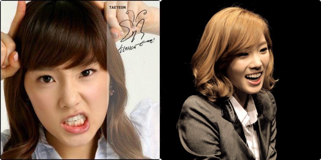 Xem loạt ảnh Before - After n&agrave;y mới thấy c&ocirc;ng nghệ thẩm mỹ răng đ&atilde; gi&uacute;p c&aacute;c idol xứ H&agrave;n l&ecirc;n đời nhan sắc như thế n&agrave;o - Ảnh 1.