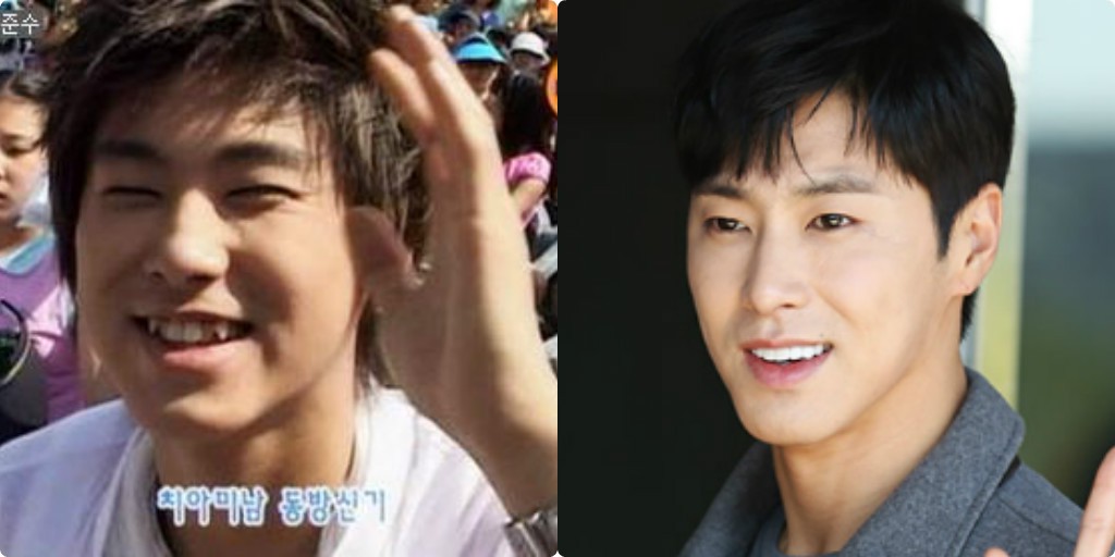 Xem loạt ảnh Before - After n&agrave;y mới thấy c&ocirc;ng nghệ thẩm mỹ răng đ&atilde; gi&uacute;p c&aacute;c idol xứ H&agrave;n l&ecirc;n đời nhan sắc như thế n&agrave;o - Ảnh 10.