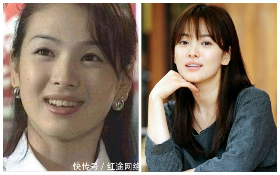 Xem loạt ảnh Before - After n&agrave;y mới thấy c&ocirc;ng nghệ thẩm mỹ răng đ&atilde; gi&uacute;p c&aacute;c idol xứ H&agrave;n l&ecirc;n đời nhan sắc như thế n&agrave;o - Ảnh 15.