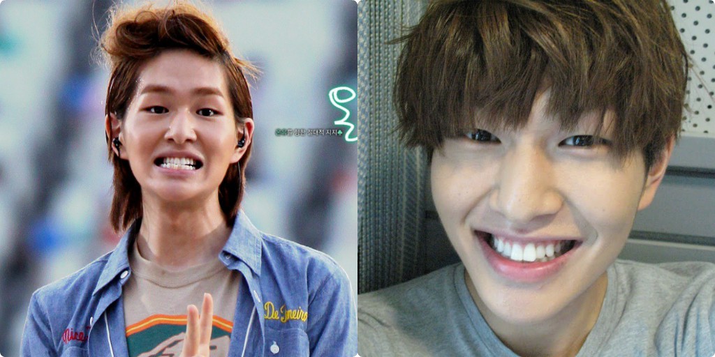 Xem loạt ảnh Before - After n&agrave;y mới thấy c&ocirc;ng nghệ thẩm mỹ răng đ&atilde; gi&uacute;p c&aacute;c idol xứ H&agrave;n l&ecirc;n đời nhan sắc như thế n&agrave;o - Ảnh 2.