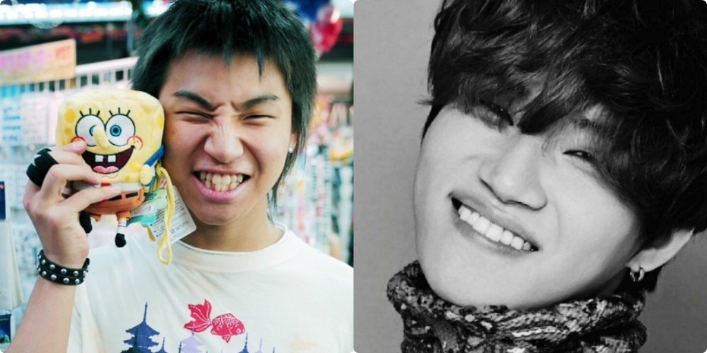 Xem loạt ảnh Before - After n&agrave;y mới thấy c&ocirc;ng nghệ thẩm mỹ răng đ&atilde; gi&uacute;p c&aacute;c idol xứ H&agrave;n l&ecirc;n đời nhan sắc như thế n&agrave;o - Ảnh 3.