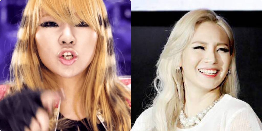 Xem loạt ảnh Before - After n&agrave;y mới thấy c&ocirc;ng nghệ thẩm mỹ răng đ&atilde; gi&uacute;p c&aacute;c idol xứ H&agrave;n l&ecirc;n đời nhan sắc như thế n&agrave;o - Ảnh 6.