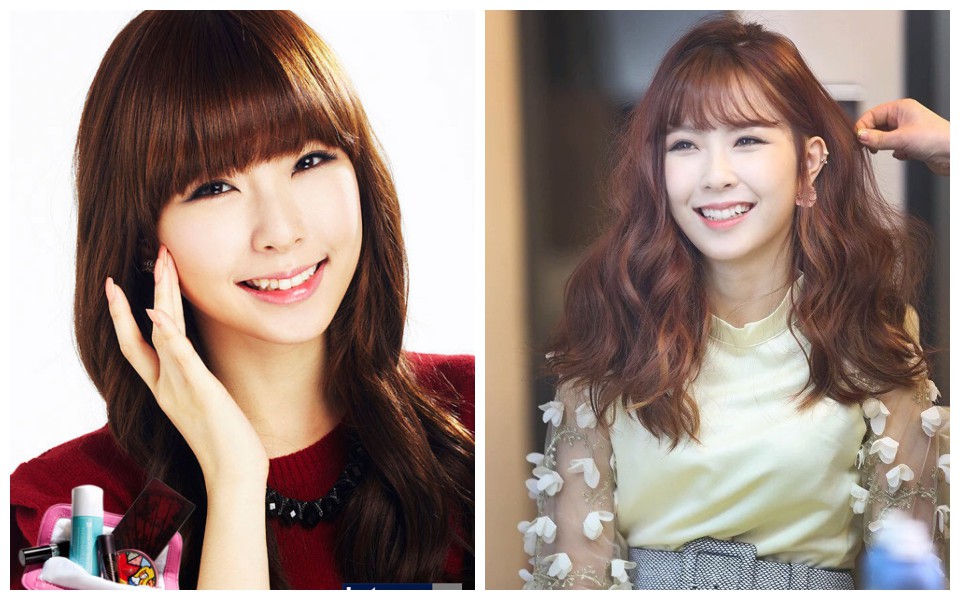 Xem loạt ảnh Before - After n&agrave;y mới thấy c&ocirc;ng nghệ thẩm mỹ răng đ&atilde; gi&uacute;p c&aacute;c idol xứ H&agrave;n l&ecirc;n đời nhan sắc như thế n&agrave;o - Ảnh 8.