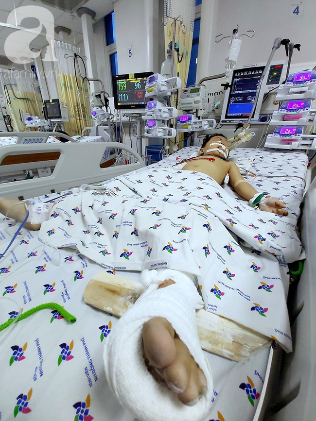 Mẹ bận l&agrave;m việc nh&agrave;, b&eacute; trai 5 tuổi ra lan can chơi th&igrave; rớt từ tầng 12 xuống đất nguy kịch - Ảnh 3.